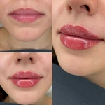 کلینیک لیزر , زیبایی و لاغری نوران