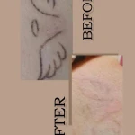 کلینیک زیبایی درناز (تخفیف ویژه لیزر)