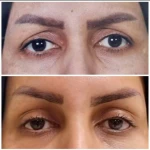 جراحی  زیبایی بینی  و صورت نئوفیس