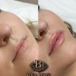 تصویر کلینیک زیبایی بلژو