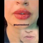 کلینیک زیبایی مرکز لیزر دکترپروانه نوری