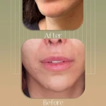 کلینیک پوست مو زیبایی حضور