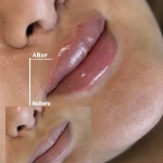 نمونه کار مرکز لیزر ،پوست و زیبایی کندی بیوتی