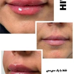کلنیک پوست مو زیبای لیزر هیوا