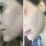 فیشال تخصصی و درمانی میسون