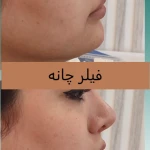 کلینیک پوست مو لیزر لاغری زیباریس