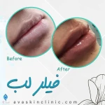 کلینیک پوست و مو آوا