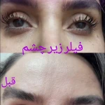 نمونه کار مطب پوست ،مو زیبایی دکتر فاطمه قره داغی