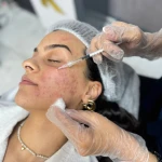  کیلینک پوست مو و لیزر نورا