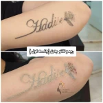 کلینیک پوست مو زیبایی و لیرزگلدن بادي