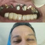 نمونه کار دندانسازی و دندانپزشکی