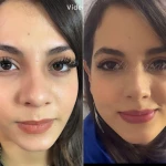 کلینیک پوست مو زیبایی و لیزر سارا