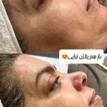 فیشال تخصصی  سعیده صدیقی