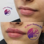 مطب زیبایی دکتر مینو شعبانی