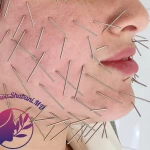 مطب زیبایی دکتر مینو شعبانی