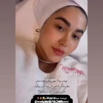 خدمات تخصصی فیشال و پاکسازی پوست حفظی