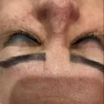 نمونه کار پاکسازی و جوانسازی پوست سمیرا صادقی