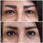 جراحی  زیبایی بینی  و صورت نئوفیس