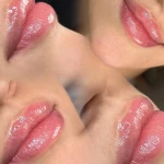 تصویر کلینیک آیریس