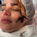 نمونه کار کلینیک زیبایی و درمانی آریما