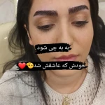 نمونه کار کاشت و اکستیشن