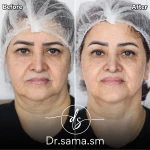  مطب پوست و مو زیبایی دکتر سما