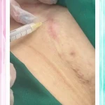 نمونه کار كلينيك زيبايي و ليزر بيوتا (شعبه رسالت)