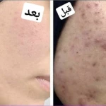 تصویر فیشال تخصصی و درمانی میسون