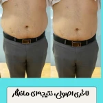 کلینیک زیبایی و لاغری الماس غرب