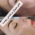 نمونه کار کلنیک زیبایی و لیزر نایس