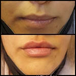 دکتر محمد امید بهترین دکتر زیبایی کانتور