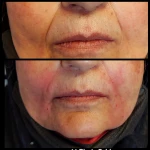 دکتر محمد امید بهترین دکتر زیبایی کانتور