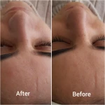  فیشال و مراقبتهای تخصصی پوست