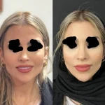 تصویر کلینیک زیبایی و مرکز لیزر موی زائد آریسا