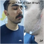 کلینیک زیبایی و لیزر مو گندم