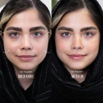 نمونه کار کلینیک زیبایی و لاغری دکتر ناظری