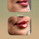 کلینیک پوست مو زیبایی حضور