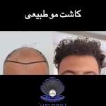 کلینیک پوست و مو ملورین  دکتر محمدی