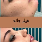 کلینیک پوست مو لیزر لاغری زیباریس