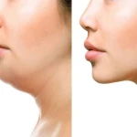 تصویر کلینیک زیبایی و بوتاکس دکتر مهشید طالبی