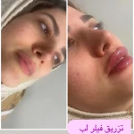 کیلینیک فوق تخصصی پوست ، مو ، زیبایی آراد