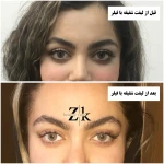 نمونه کار كلينيك زیبایی زهرا کیا