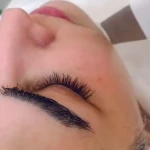 پاکسازی پوست و فیشال تخصصی و درمانی الا