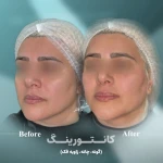 مطب پوست زيبايی ليزر دکتر شاه نعمت الهی