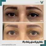 کلینیک پوست ، مو و لیزر نارینا