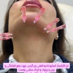 تصویر کلنیک زیبایی و لیزر نایس
