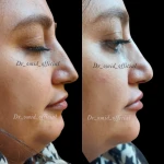 دکتر محمد امید بهترین دکتر زیبایی کانتور