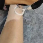 تصویر کلینیک زیبایی و لیزر موهای زائد باران