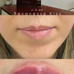 کلینیک لیزر و زیبایی البرز