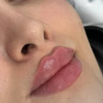 کلینیک زیبایی و لیزر دکتر حکیم پور